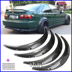 For Honda Civic Del Sol 35 Fender Flares Arches Widebody Mudguard CARBON Look