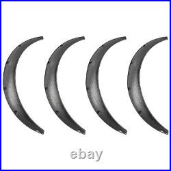 For Honda Civic Del Sol 35 Fender Flares Arches Widebody Mudguard CARBON Look